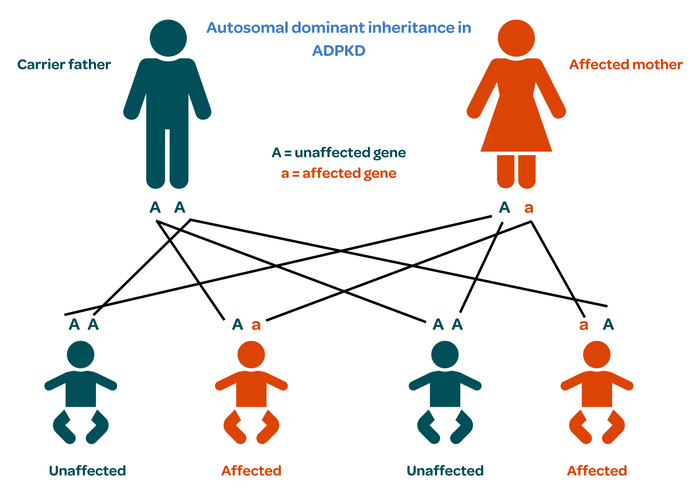 ADPKD - inheritance diagram