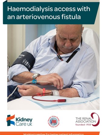 Haemodialysis access with an arteriovenous fistula - Kidney Care UK
