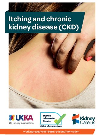 Itching and chronic kidney disease - Kidney Care UK