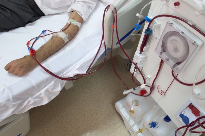Man laying in a hospital bed receiving haemodialysis treatment