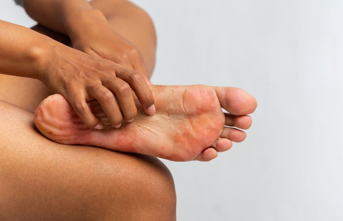 Foot care