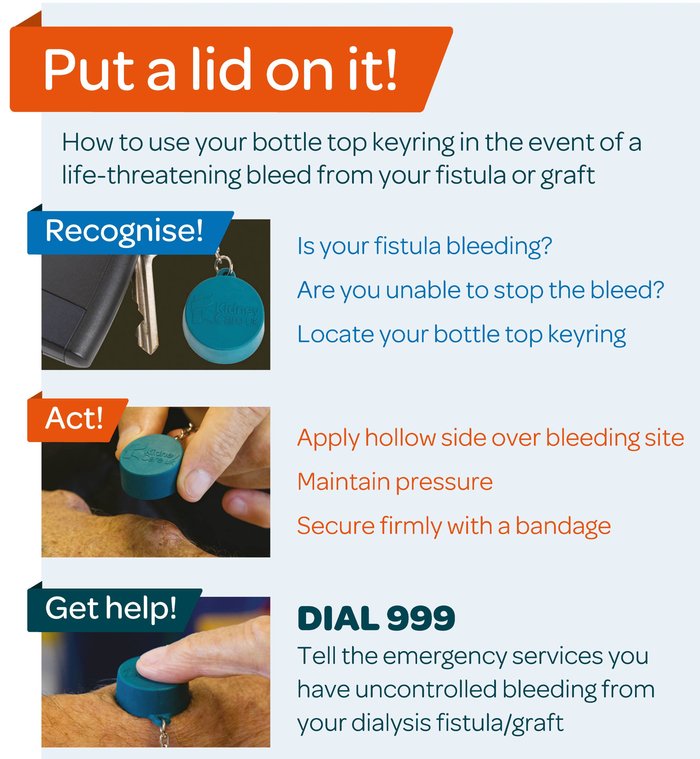 vascular access - controlling bleeds - put a lid on it infographic